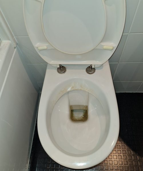 dirty toilet - Skyline Cleaning